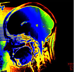 Do you find my brain? - Auf der Suche nach mei...